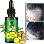 7 Days Ginger Hair Serum – 30ml Hair & Scalp Care Oil