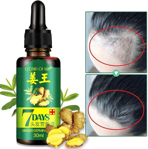 7 Days Ginger Hair Serum – 30ml Hair & Scalp Care Oil