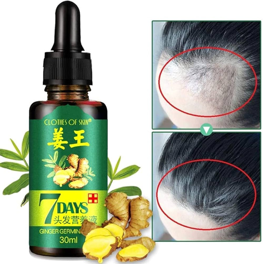 7 Days Ginger Hair Serum – 30ml Hair & Scalp Care Oil